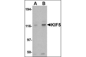 Western blot analysis of KIF5 in K562 cell lysate with this product at (A) 0. (KIF5A anticorps  (Center))