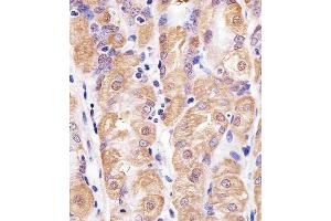 Immunohistochemical analysis of paraffin-embedded H.