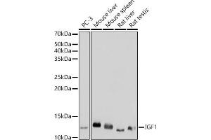 Western blot analysis of extracts of various cell lines, using IGF1 antibody (ABIN1682184, ABIN3015345, ABIN3015346 and ABIN7101347) at 1:1000 dilution. (IGF1 anticorps)