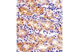 (ABIN6242877 and ABIN6578324) staining SLC22A2 in human stomach tissue sections by Immunohistochemistry (IHC-P - paraformaldehyde-fixed, paraffin-embedded sections). (SLC22A2 anticorps  (N-Term))
