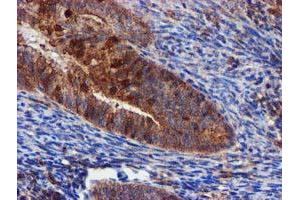 Image no. 1 for anti-Epsin 2 (EPN2) antibody (ABIN1498050)