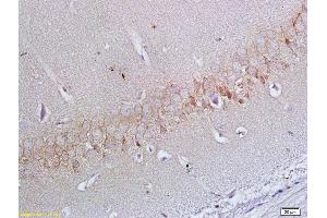 Formalin-fixed and paraffin embedded rat brain labeled with Anti-ApoER2 Polyclonal Antibody, Unconjugated (ABIN719426) at 1:200 followed by conjugation to the secondary antibody and DAB staining (LRP8 anticorps  (AA 851-963))