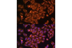 Immunofluorescence analysis of U2OS cells using NF2 antibody (ABIN6128275, ABIN6144548, ABIN6144551 and ABIN7101344) at dilution of 1:100.