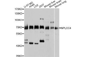 Western blot analysis of extracts of various cell lines, using NPLOC4 antibody (ABIN4904565) at 1:3000 dilution. (NPLOC4 anticorps)
