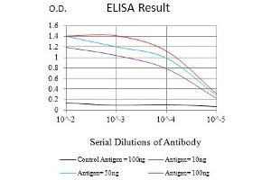 Black line: Control Antigen (100 ng),Purple line: Antigen (10 ng), Blue line: Antigen (50 ng), Red line:Antigen (100 ng)