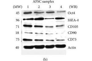 Effect of donor heterogeneity on stem cells markers. (CD73 anticorps)