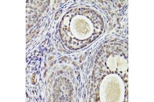 Immunohistochemistry of paraffin-embedded rat ovary using  Rabbit pAb (ABIN7265407) at dilution of 1:25 (40x lens).
