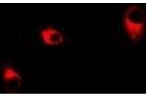 Immunofluorescent analysis of Transaldolase staining in Hela cells.