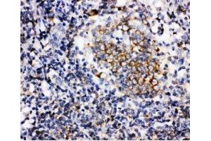 IHC-P: BAFF antibody testing of human tonsil tissue (BAFF anticorps  (AA 265-285))