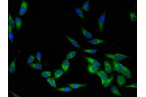 Immunofluorescent analysis of Hela cells using ABIN7174038 at dilution of 1:100 and Alexa Fluor 488-congugated AffiniPure Goat Anti-Rabbit IgG(H+L)