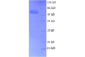 Fibroblast Growth Factor 5 (FGF5) (AA 18-268), (full length) protein (GST tag)