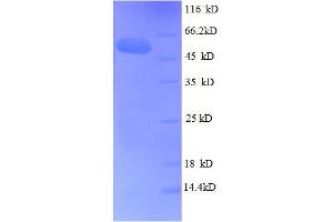 Fibroblast Growth Factor 5 (FGF5) (AA 18-268), (full length) protein (GST tag) (FGF5 Protein (AA 18-268, full length) (GST tag))