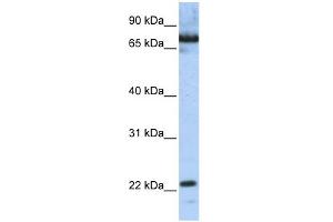 WB Suggested Anti-SCAND1 Antibody Titration:  0.