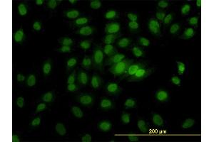 Immunofluorescence of monoclonal antibody to CSE1L on HeLa cell. (Exportin 2 anticorps  (AA 872-971))