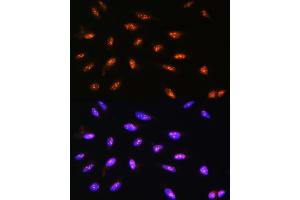 Immunofluorescence analysis of U2OS cells using LYAR Rabbit pAb  at dilution of 1:100.