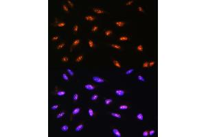 Immunofluorescence analysis of U2OS cells using LYAR Rabbit pAb  at dilution of 1:100. (LYAR anticorps  (AA 10-160))