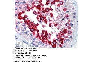 Immunohistochemistry with Human Testis lysate tissue at an antibody concentration of 5. (JAZF1 anticorps  (C-Term))