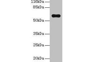 Western blot All lanes: Pklr antibody at 2 μg/mL + Hela whole cell lysate Secondary Goat polyclonal to rabbit IgG at 1/10000 dilution Predicted band size: 63, 59 kDa Observed band size: 63 kDa (PKLR anticorps  (AA 1-574))
