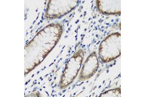 Immunohistochemistry of paraffin-embedded human stomach using TTBK2 antibody (ABIN6131392, ABIN6149666, ABIN6149669 and ABIN6223523) at dilution of 1:200 (40x lens). (TTBK2 anticorps  (AA 1185-1244))