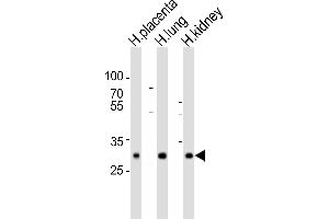 Western blot analysis of lysates from human placenta, human lung, human kidney tissue lysate (from left to right), using SOD3 Antibody (C-term) (ABIN6242639 and ABIN6577764). (SOD3 anticorps  (C-Term))