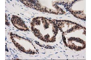 Image no. 1 for anti-Pyrroline-5-Carboxylate Reductase 3 (PYCRL) antibody (ABIN1500522)