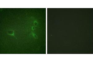 P-peptide - +Immunofluorescence analysis of NIH/3T3 cells, using Bcr (Phospho-Tyr360) antibody. (BCR anticorps  (pTyr360))