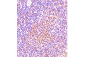 Immunohistochemistry of TANK in rat spleen tissue with this product at 10 μg/ml. (TANK anticorps  (C-Term))