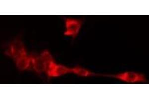 ABIN6275082 staining LOVO cells by IF/ICC. (DNAI2 anticorps  (N-Term))