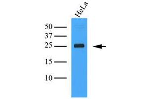 The Cell lysates (40ug) were resolved by SDS-PAGE, transferred to PVDF membrane and probed with anti-human MINCLE antibody (1:1000). (CLEC4E anticorps)