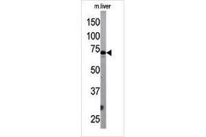 The ATG7 Antibody (Center) Pab (ABIN388521 and ABIN2849641) is used in Western blot to detect G7L in mouse liver tissue lysate. (ATG7 anticorps  (AA 284-313))