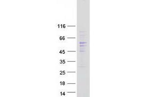 Validation with Western Blot