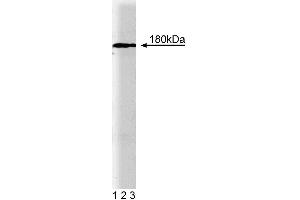 Western blot analysis of EEA1 on rat brain lysate.