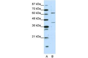 WB Suggested Anti-FOXP4 Antibody Titration:  1. (FOXP4 anticorps  (C-Term))