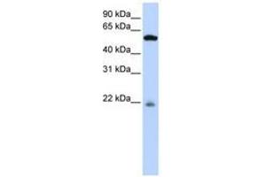 Image no. 1 for anti-Peptidase M20 Domain Containing 2 (PM20D2) (AA 252-301) antibody (ABIN6741115)
