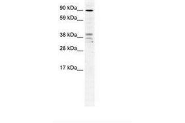 ZC3H7B anticorps  (AA 136-185)