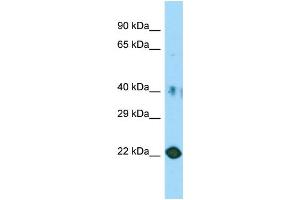 Host: Rabbit Target Name: C11orf34 Sample Type: HT1080 Whole Cell lysates Antibody Dilution: 1.