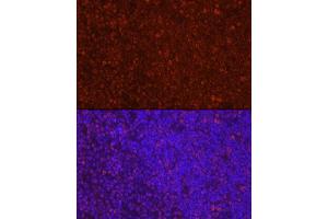 Immunofluorescence (IF) image for anti-Lymphoid Enhancer-Binding Factor 1 (LEF1) (AA 100-399) antibody (ABIN5663810)