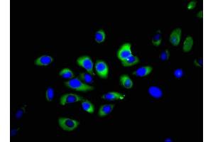 Immunofluorescent analysis of A549 cells using ABIN7161071 at dilution of 1:100 and Alexa Fluor 488-congugated AffiniPure Goat Anti-Rabbit IgG(H+L)