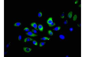 Immunofluorescent analysis of A549 cells using ABIN7161071 at dilution of 1:100 and Alexa Fluor 488-congugated AffiniPure Goat Anti-Rabbit IgG(H+L) (NCR1 anticorps  (AA 121-230))