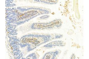 ABIN6256620 and ABIN6267337 at 1/100 staining Mouse colon tissue by IHC-P.