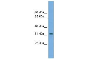 WB Suggested Anti-DAPP1  Antibody Titration: 0. (DAPP1 anticorps  (Middle Region))