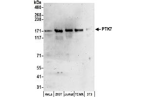 Western Blotting (WB) image for anti-PTK7 Protein tyrosine Kinase 7 (PTK7) (AA 700-750) antibody (ABIN7450617)