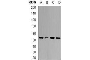 Western blot analysis of Ubiquilin 4 expression in HEK293T (A), K562 (B), NIH3T3 (C), mouse brain (D) whole cell lysates. (UBQLN4 anticorps)
