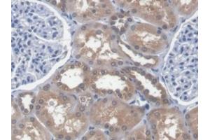 Detection of EEF1a1 in Human Kidney Tissue using Polyclonal Antibody to Eukaryotic Translation Elongation Factor 1 Alpha 1 (EEF1a1)