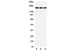 Western blot testing of LRP5 antibody and Lane 1:  rat liver (LRP5 anticorps  (C-Term))