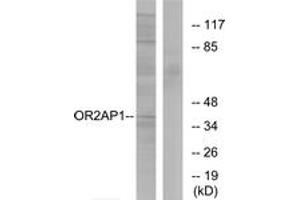 Western blot analysis of extracts from Jurkat cells, using OR2AP1 Antibody. (OR2AP1 anticorps  (AA 231-280))
