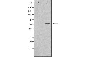 Western blot analysis of extracts from HeLa cells using Cytochrome P450 2A13 antibody.