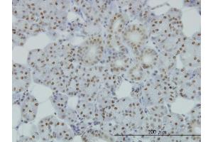 Immunoperoxidase of monoclonal antibody to SMC1L1 on formalin-fixed paraffin-embedded human salivary gland. (SMC1A anticorps  (AA 366-465))