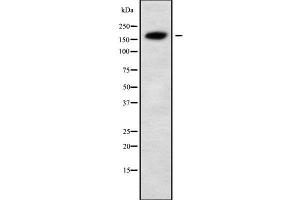 Western blot analysis of ALS2 using MCF7 whole cell lysates (ALS2 anticorps  (N-Term))