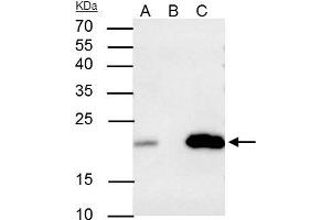 IP Image Caveolin 2 antibody immunoprecipitates caveolin 2 protein in IP experiments.